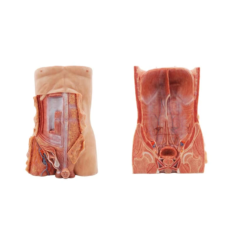 Inguinal Hernia Model Inguinal Hernia Model